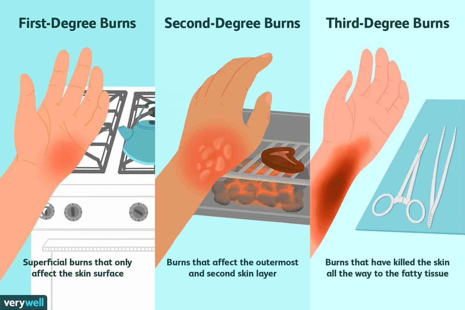 O Que Significa Burn SOLOLEARN