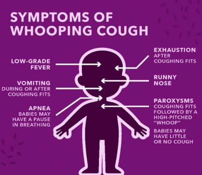 symptoms of pertussis