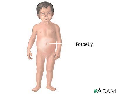 what is potbelly