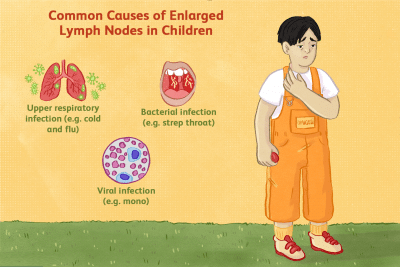 common causes of enlarged lymph node in children