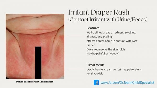 yeast vs regular diaper rash