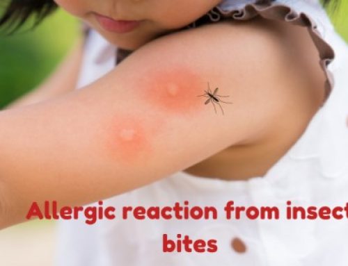 Insect bites and children